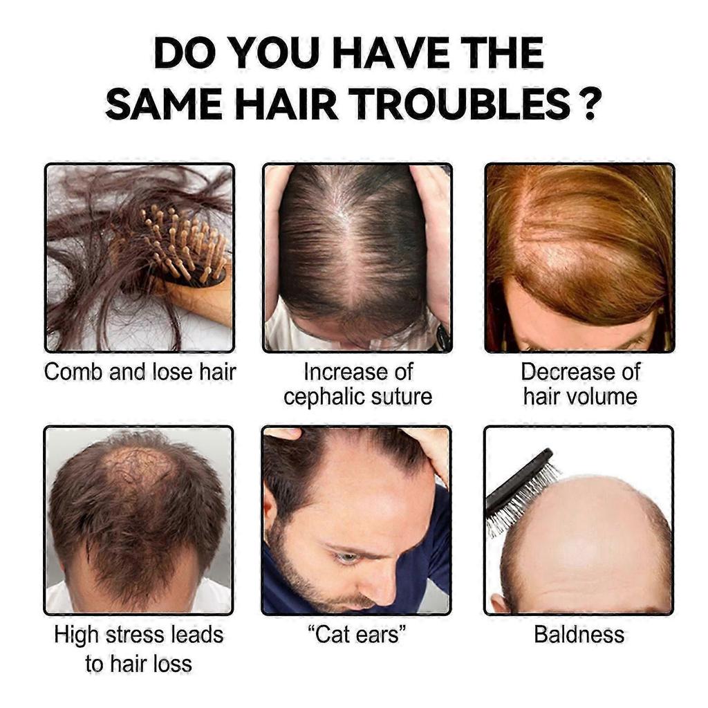 Ginger Hair Care Powder - Natural Moisturizing & Strengthening Treatment for Thicker, Darker Hair | Stimulates Hair Growth, Reduces Hair Loss, 8g Trav