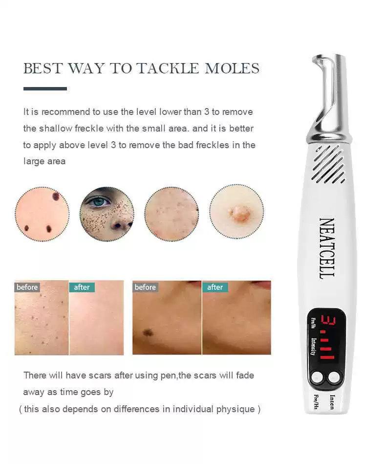 Portable Picosecond Laser Pen for Mole and Freckle Removal with Red and Blue Light