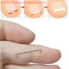 Ingrown Toenail Corrector Tools Pedicure Recover Embed Toe Nail Professional Ingrown Toenail Straightening Clip Brace