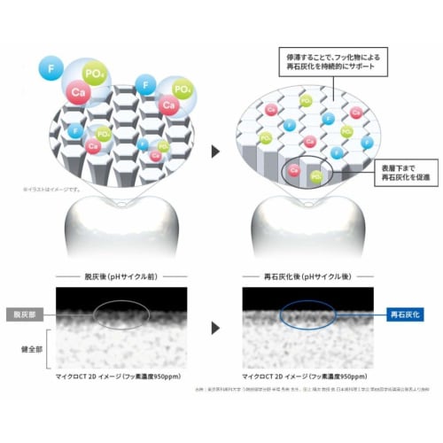 Clinpro 3M Toothpaste Paste F1450 Citrus Mint Flavor 90g x 3 bottles