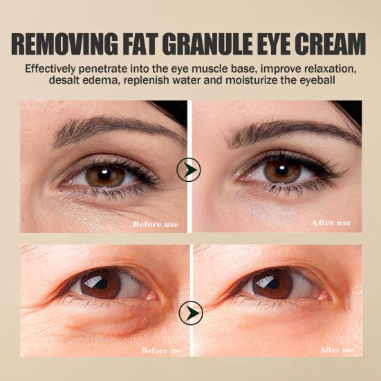 Cream Efficient Fast Absorption Non-irritating Smooth Natural Lighten Dark Circles Wide Application Gentian