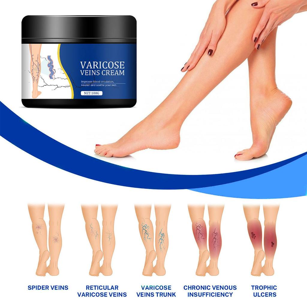 Vein Soothing Ointment To Reduce Calf And Thigh Earthworm Lines And Blue Veins 100g