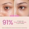 O3+ Eye Circle Cream 15g Pack of 1 Brightening Dark Circles Reducing Fine Lines Moisturizing