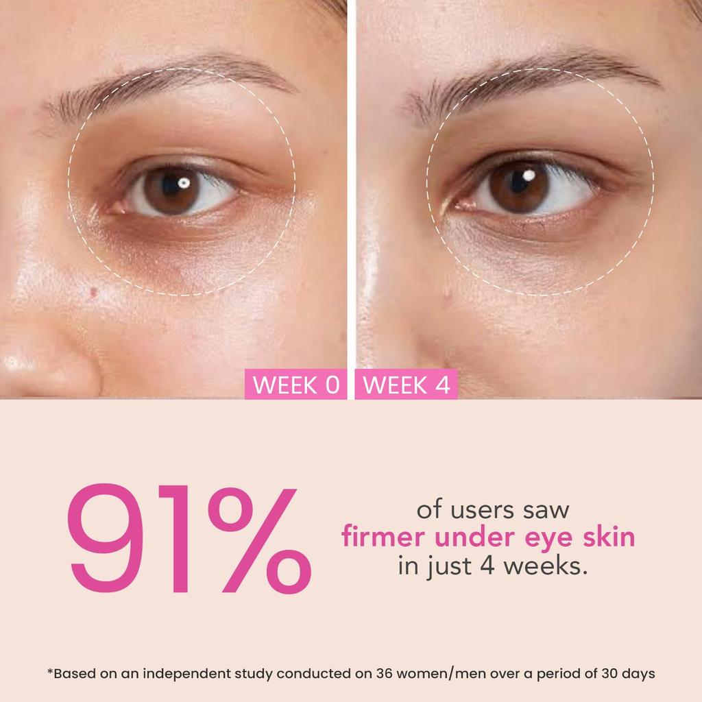 O3+ Eye Circle Cream 15g Pack of 1 Brightening Dark Circles Reducing Fine Lines Moisturizing