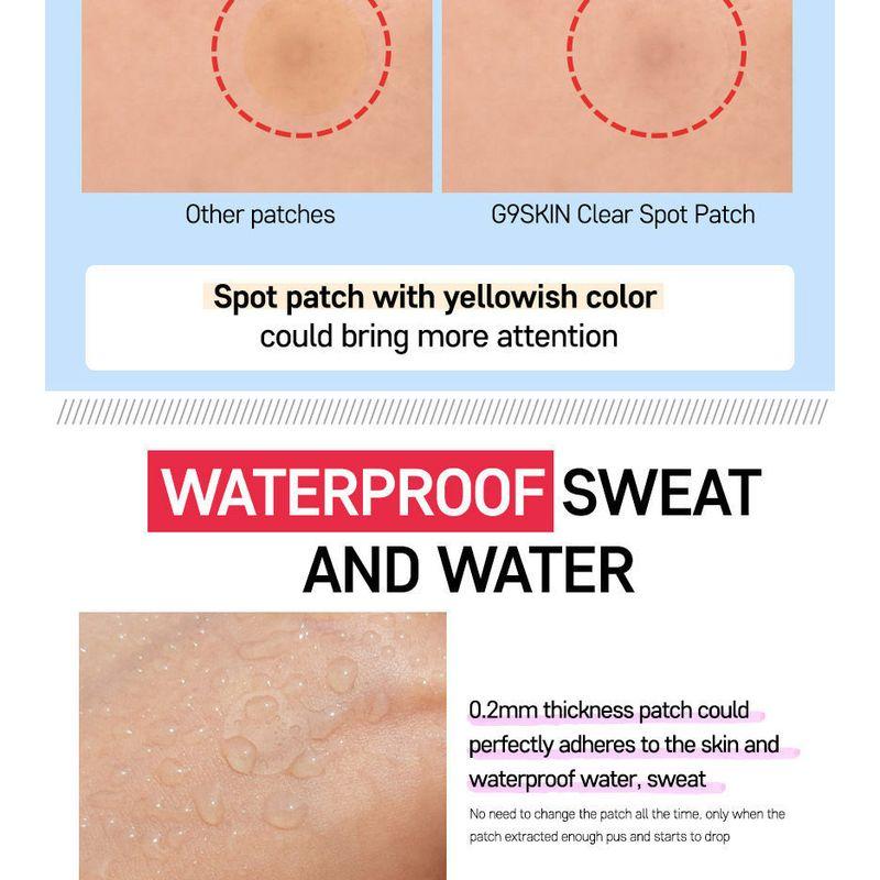 G9SKIN - Zero Solution Spot Cover Patch 108pcs