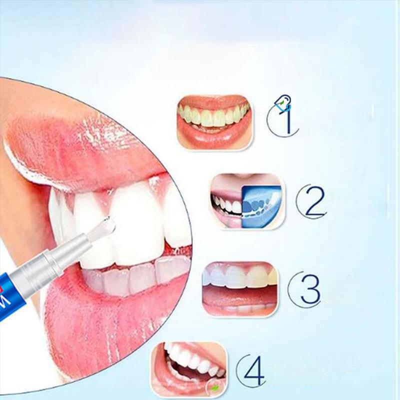

Пероксидный гель для чистки зубов, набор для отбеливания зубов, белые зубы, удаление зубного камня, отбеливающая ручка для зубов, товары для дома