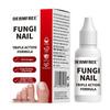 Líquido de Tratamento para Unhas Fúngicas de 15ml Líquido de Reparo e Fortalecimento de Unhas de Ação Rápida Suprimentos para Cuidado das Unhas