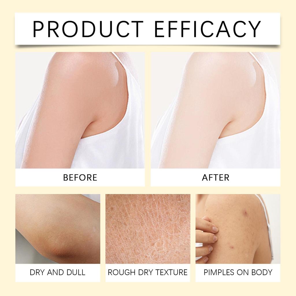 South Moon Bee Venom Skin Moisturizer Nourish Dryness Anti Cellulite Keep Brighten Improve Sagging Reduce Dull Body Care Creams