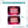 [Official] mm floraBubble (MM Flora Bubble) 2-Pack Carbonated Mouthwash - Bad Breath Care, Probiotics, Individually Packaged, Portable, Contains