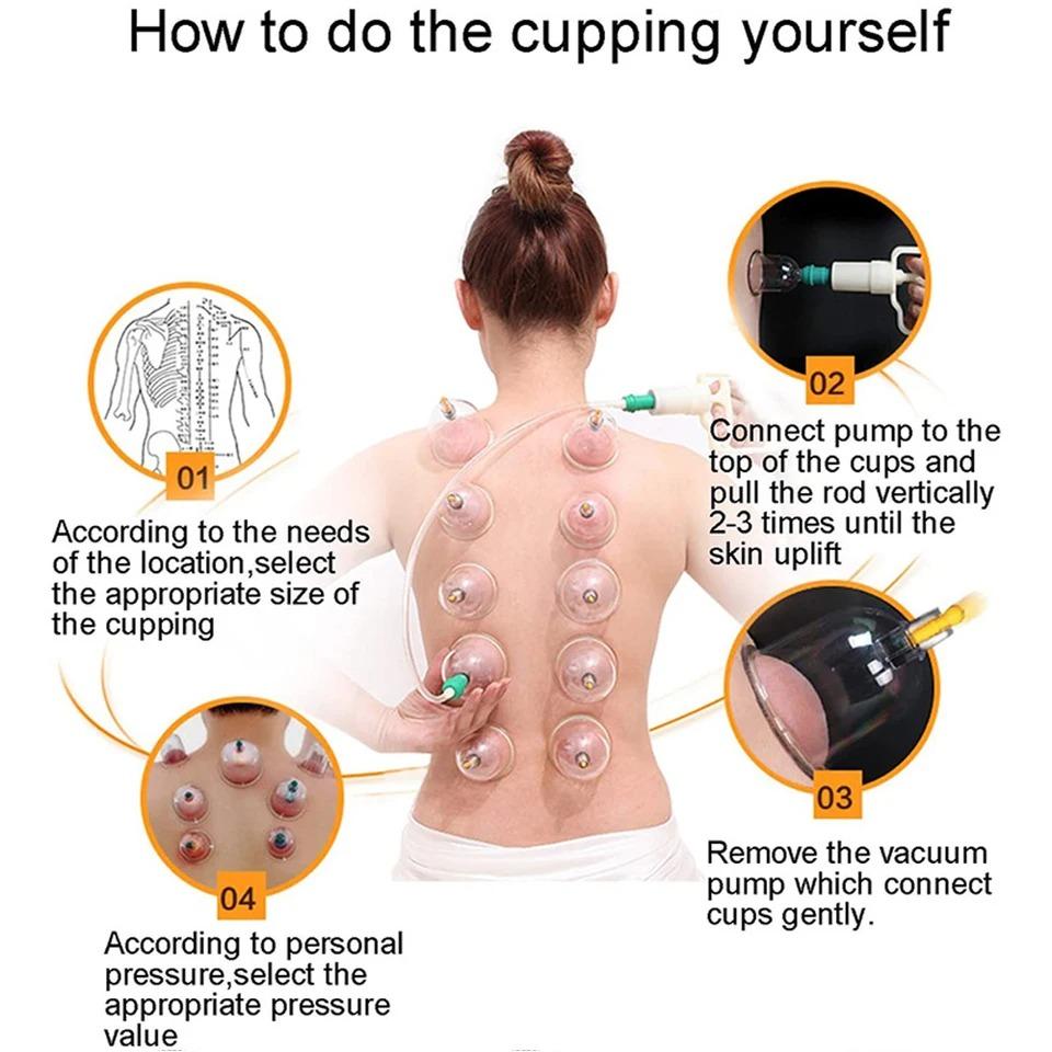 Cupping Device 12Pcs Set Vacuum Cupping For Therapy Body Massager with Magnetic Therapy Head