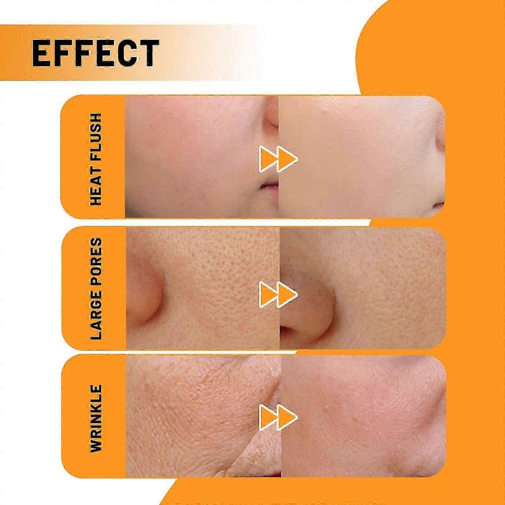 Vitamin C Face Serum - Reduces Fine Lines, Brightens Skin Tone, Hydrates & Moisturizes - 30ml