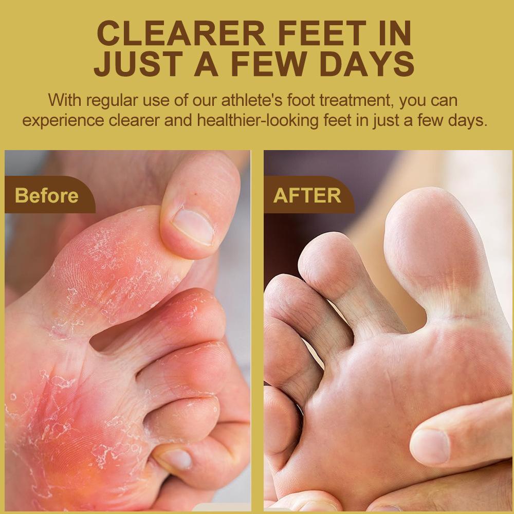 Household Foot Odor Cream, Ointment, Foot Care Discomfort Care, Foot Exercise Foot Sweat Odor Cleaning and Refreshing.