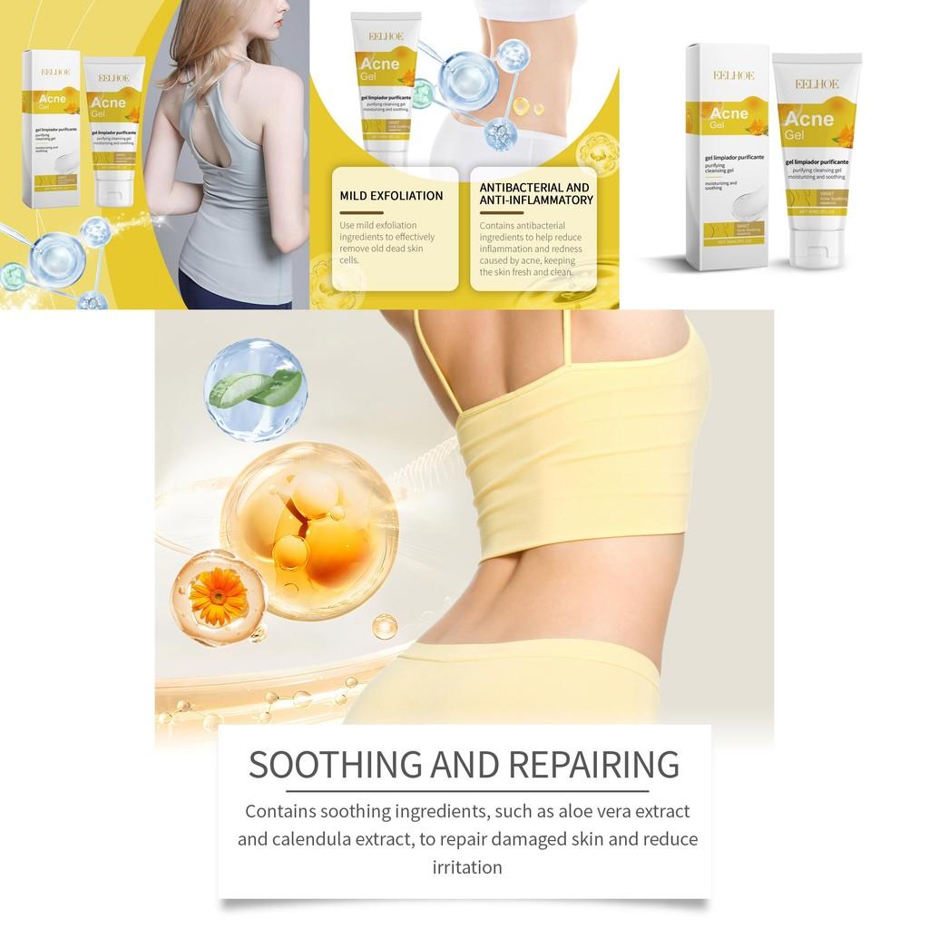 Eelhoe Soothing Acne Gel For Back Acne Gentle Skin Care Hydrating Formula 60ml