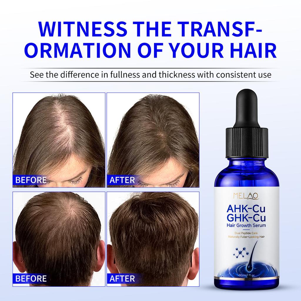 MELAO AHK-Cu GHK-Cu Double Copper Peptide Scalp Essence, Strengthening Hair Blue Copper Peptide Hair Care Serum