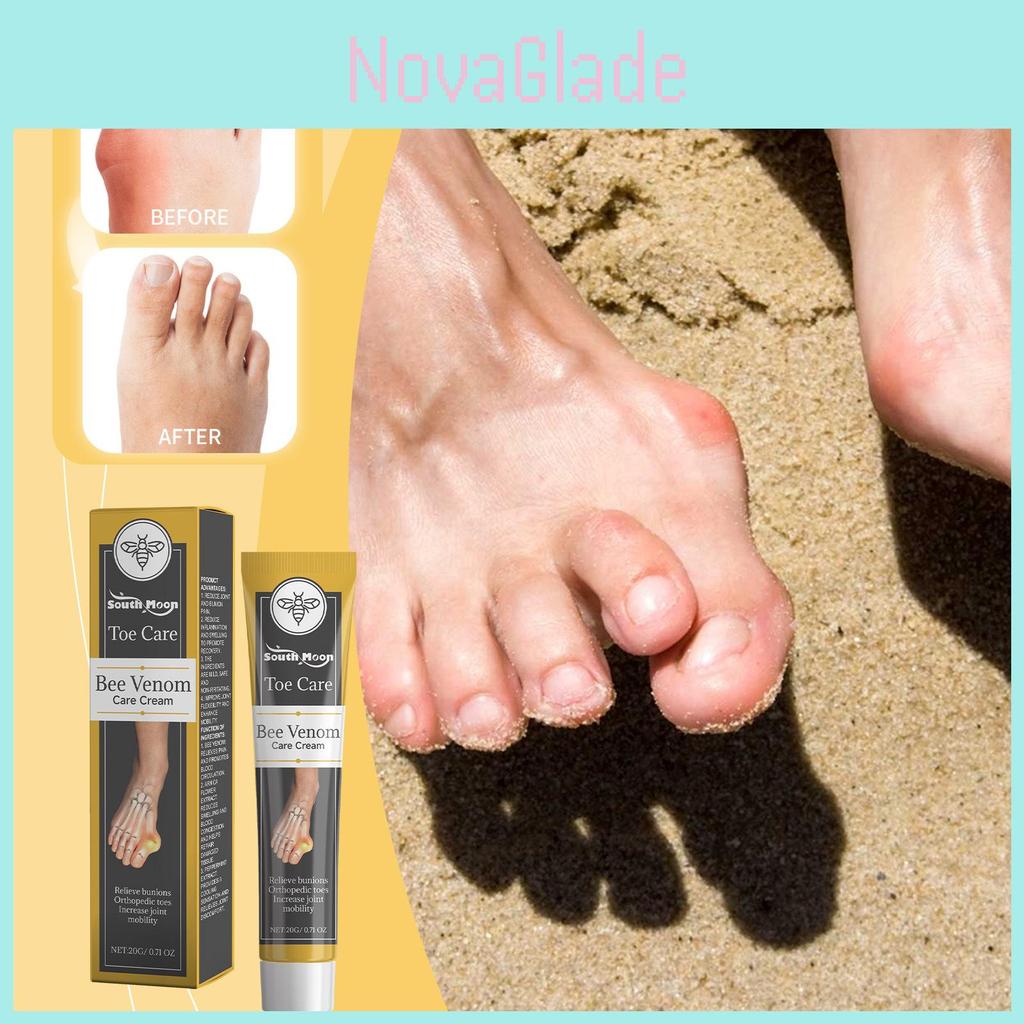 South Moon Bee Venom Care Cream For Correcting Swollen Feet And Joint Discomfort