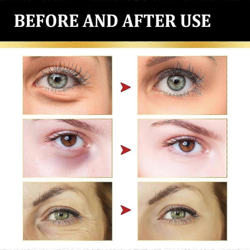 Eye Cream - Instant Tightening Eyelid Firming Cream for Anti-Aging Fine Lines & Under Eye Tightening