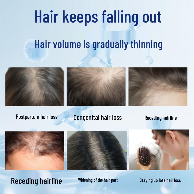 Qingsi Shijia Hair Growth & Anti-Loss Scalp Essence