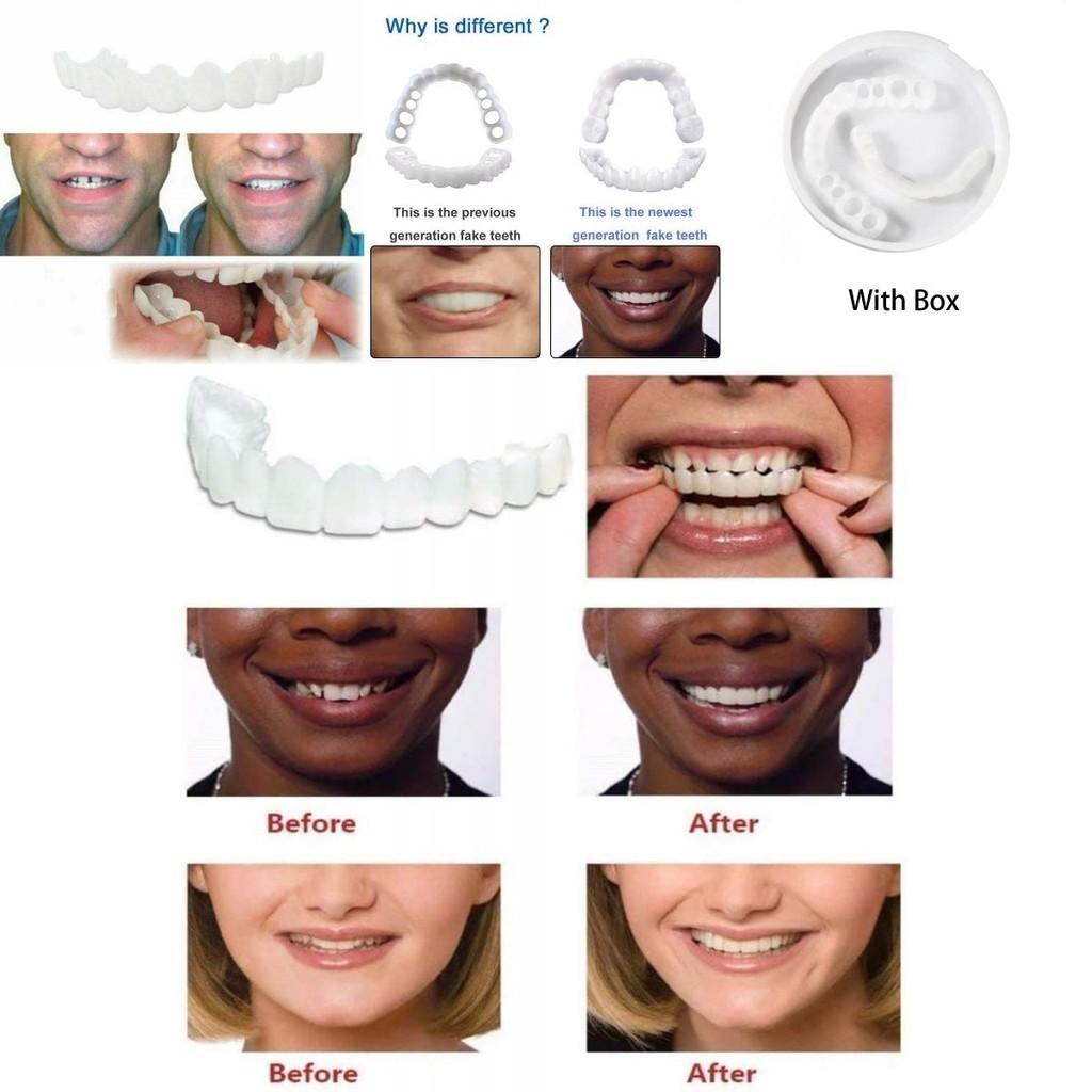 Lower Upper Teeth Dental Veneers Denture Tooth Cover Simulati Set