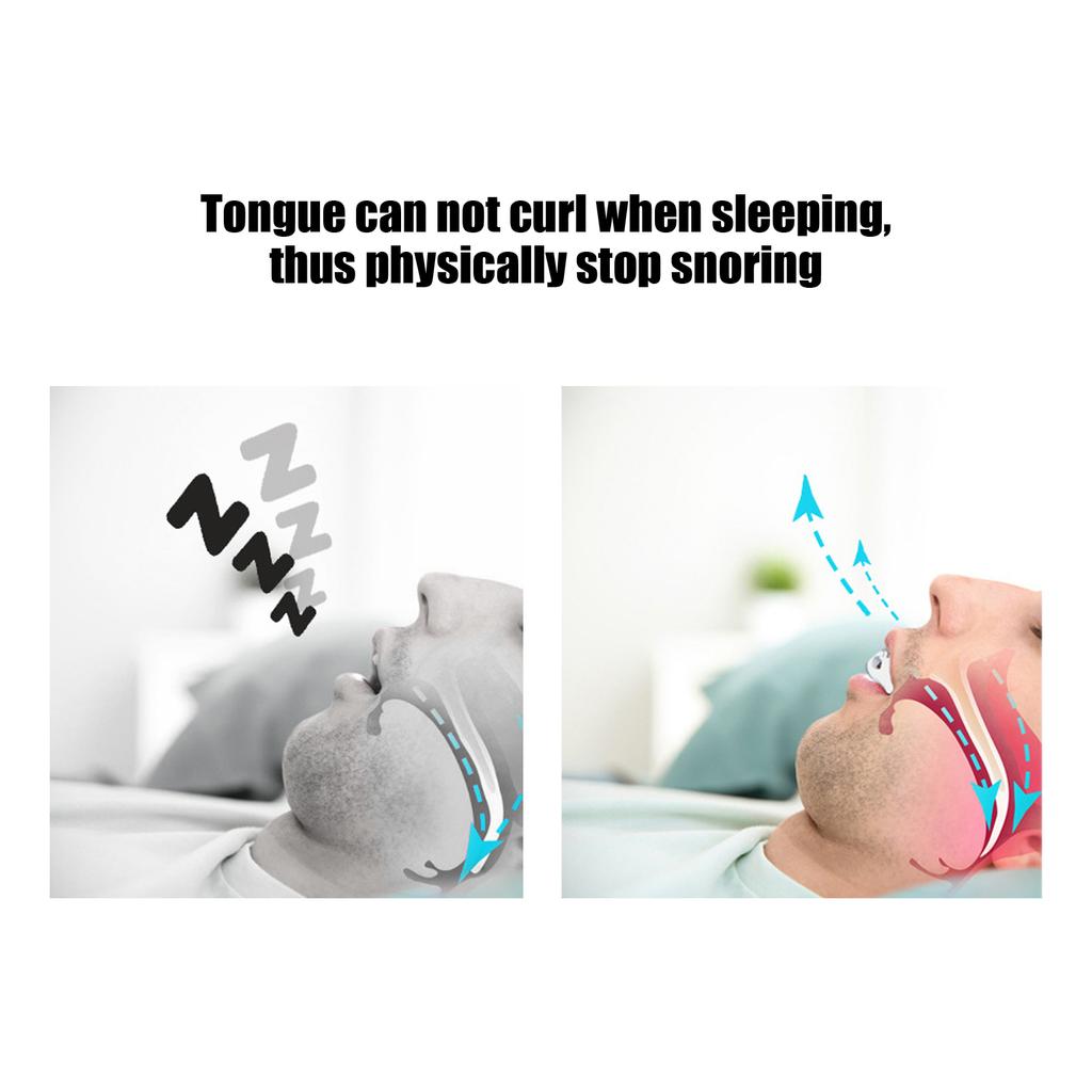 Dental Guard AntiSnoring Mouth Guard Natural Breathing Sleeping Snoring (White )
