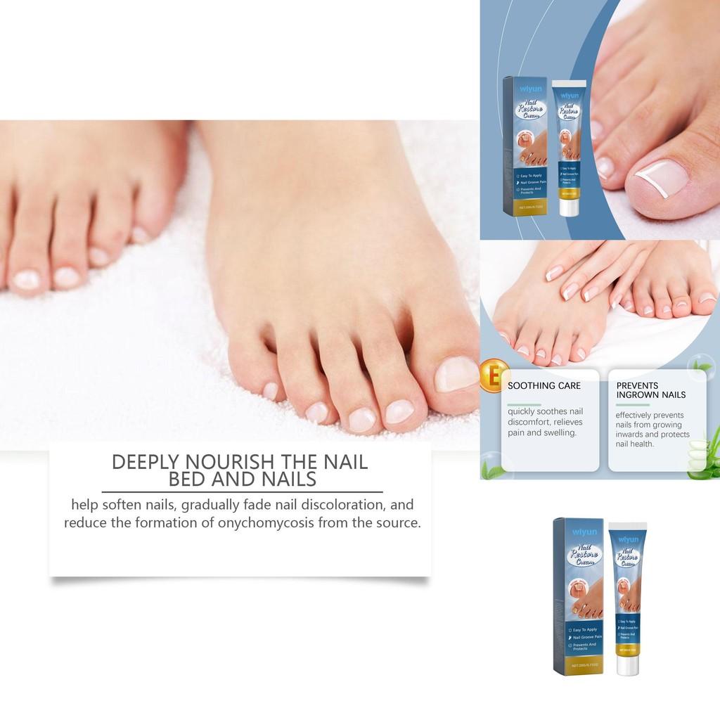 Nourishing Wiyun Nail Care Cream For Gentle Restoration And Shine Enhancing Treatment