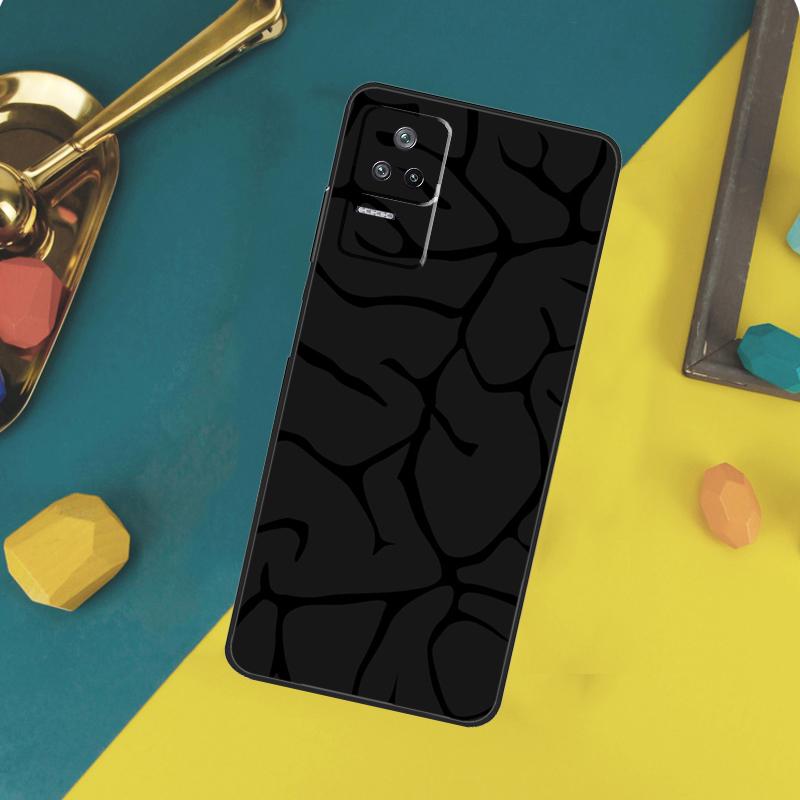 Anatomy Brain Case For Xiaomi 13 14 15 Ultra 11T 12T 13T 14T Pro POCO X7 Pro X3 X5 X6 F5 F6 M6 Pro Funda