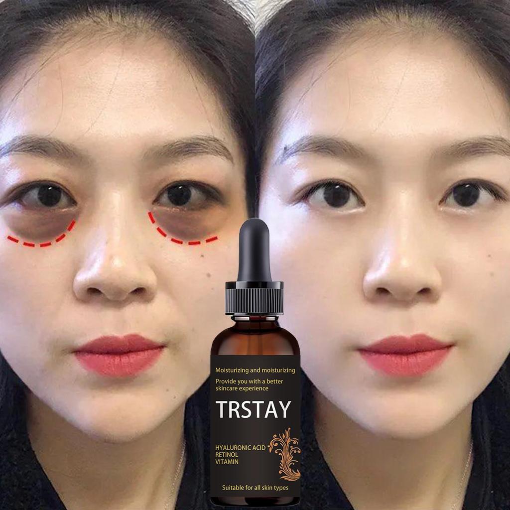 Reduce Fine Lines Improve Dark Circles Anti Puffiness Anti Aging Eye Cream