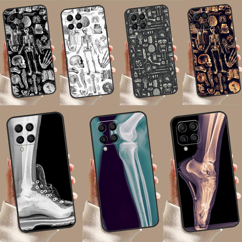 X-Ray Human Anatomy For Samsung Galaxy M54 M34 M14 M12 M32 M52 M53 M33 M13 M20 M21 M51 M15 M55 M31s M30s Case