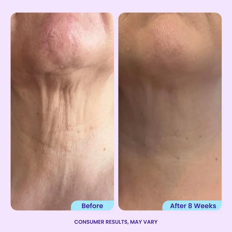 GOPURE Neck Cream Tighten & Lift Firming Cream for Crepey Skin