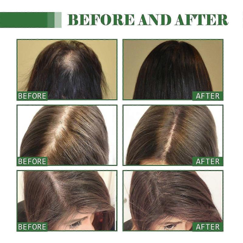 Batana Oil for Hair Growth, 100% Pure & Natural Raw Batana Oil,  Organic Raw Batana Oil from Honduras Care for Hair Thickner Longer & Scalp & Skin