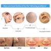 Ultrasonic Freckle Spots Removal Machine Detoxifying Face Care Machine for Home SalonUS Plug 110V