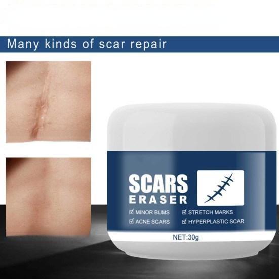 Not Irritating Repair Damage Synthetic Scar Remove Cream