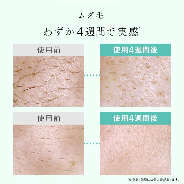 Official Store STELLA BEAUTE IPL LED Hair Removal Device with Approximately Effective Includes a Shopping Passed Medical Safety Technology in Suitable
