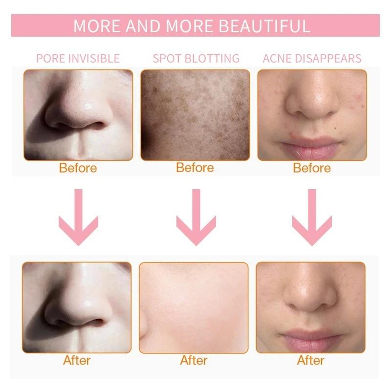 7 Colors LED Firming & Whitening Mask Facial Device - Facial & Neck Anti-Acne Professional Skin Therapy