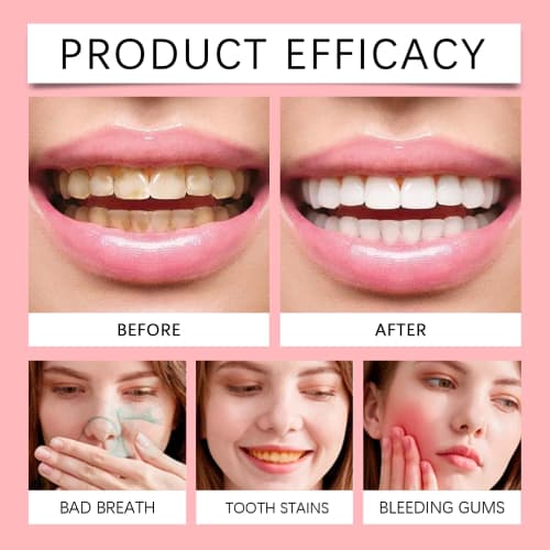 SP-10 Probiotic Whitening Toothpaste, Gum Repair Toothpaste with Probiotics and Fresh Breath, Thorough Daily Cleaning, Powerful Teeth Protection, Stai
