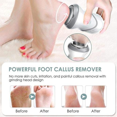 Supbel Electric Callus Remover, Electric Foot Grinder, USB Rechargeable, 3 Grinding Heads, 2 Speeds, Vacuum Electrosuction, Electronic Foot File, Call