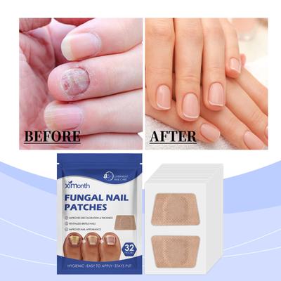 Nagelpflegepflaster Mildes Nagelpflegepflaster für die einfache tägliche Reinigung und Anwendung