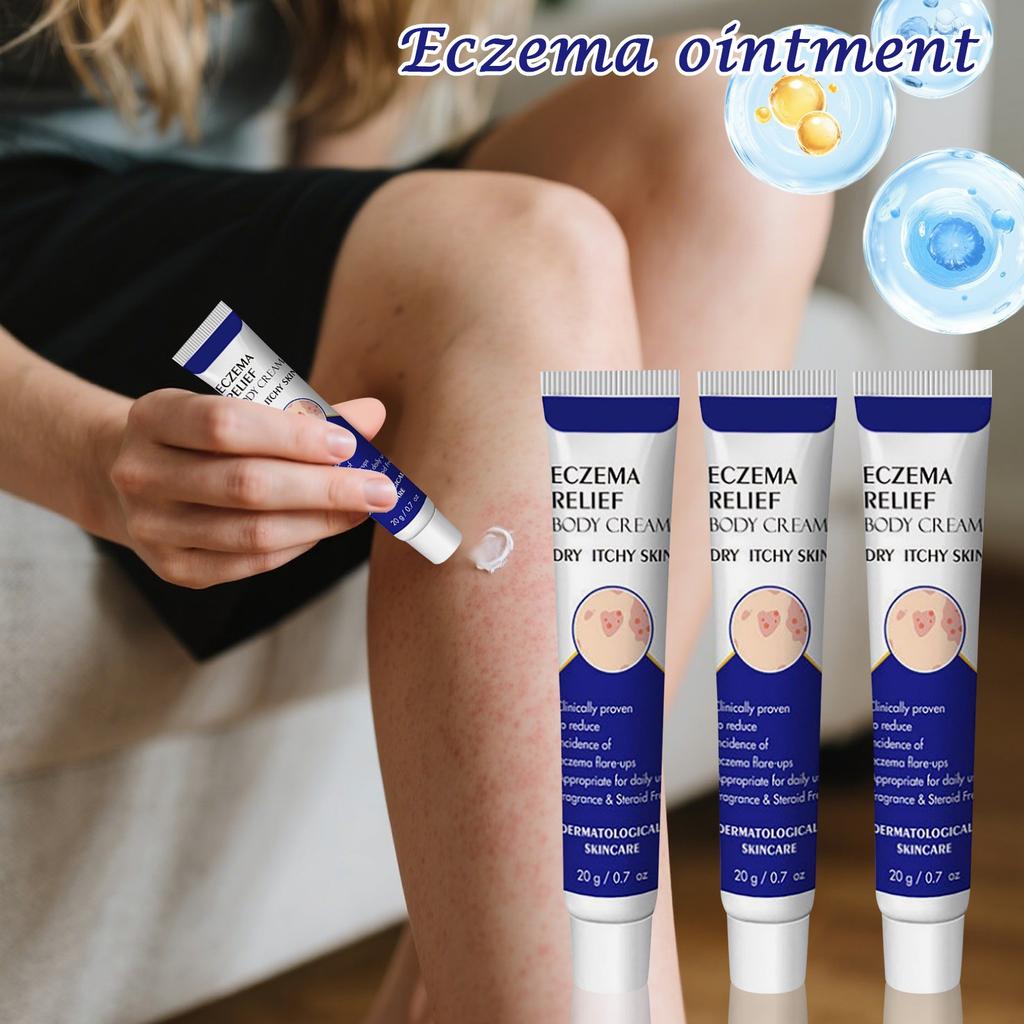 Eczema Cream 20g, Itch And Fungal Cream, Skin Care Cream For Relieving Itching And Soothing The Skin