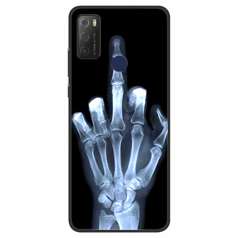 For TCL 20Y Case Shockproof Silicone Soft Phone Back Cover For TCL 20E 6125F Case TPU Bumper Coque For TCL20Y TCL20E 20 Y Funda