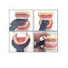 Dental Orthodontic Black Background Board Photo Image Contrast Oral Cheek Plate with Scale Mark Autoclavable Tools