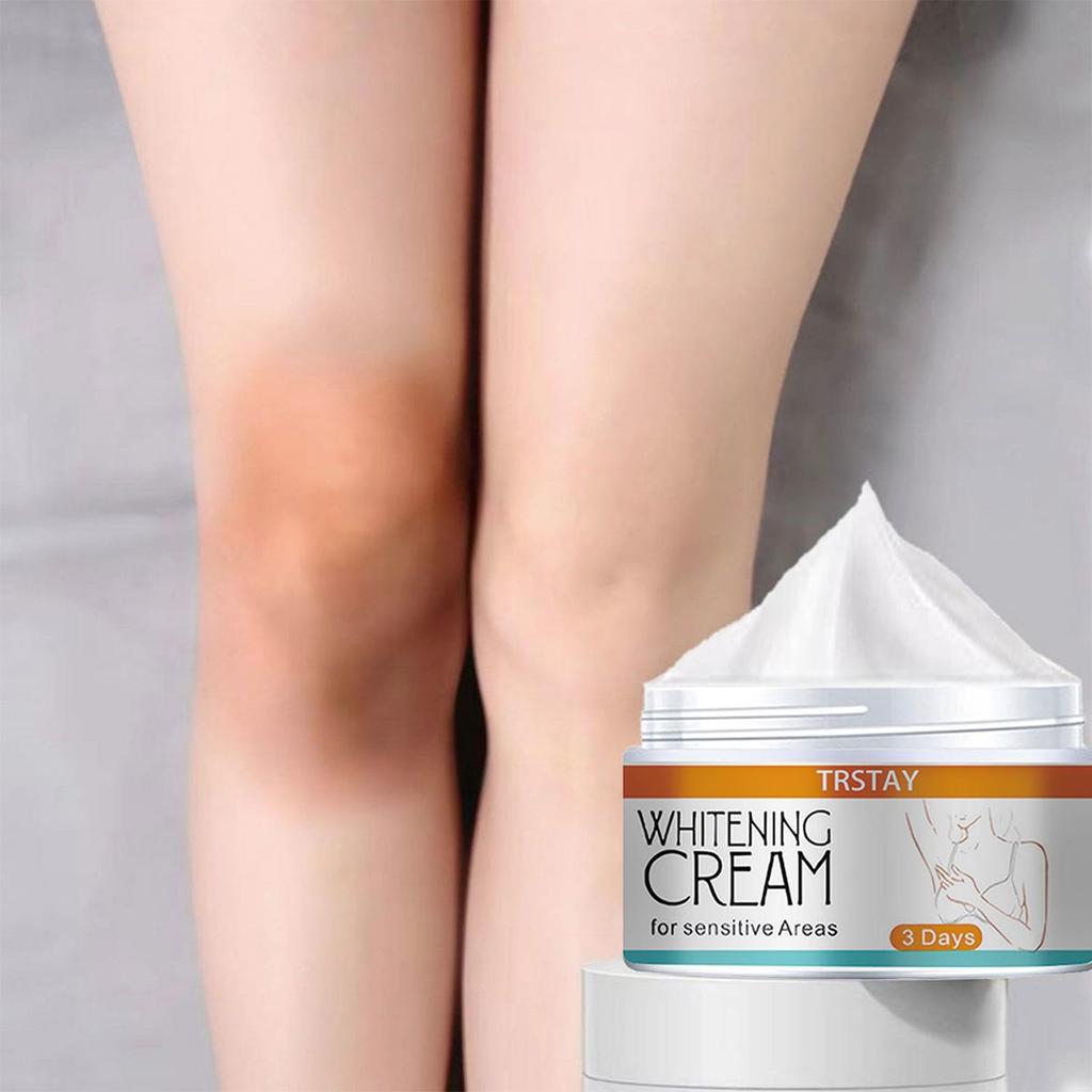 Dark Knuckles Fast Whitening Cream Pigmentation Correctors For Black Skin Hand Knuckle Elbows Knee Intense Stains Remover Cream