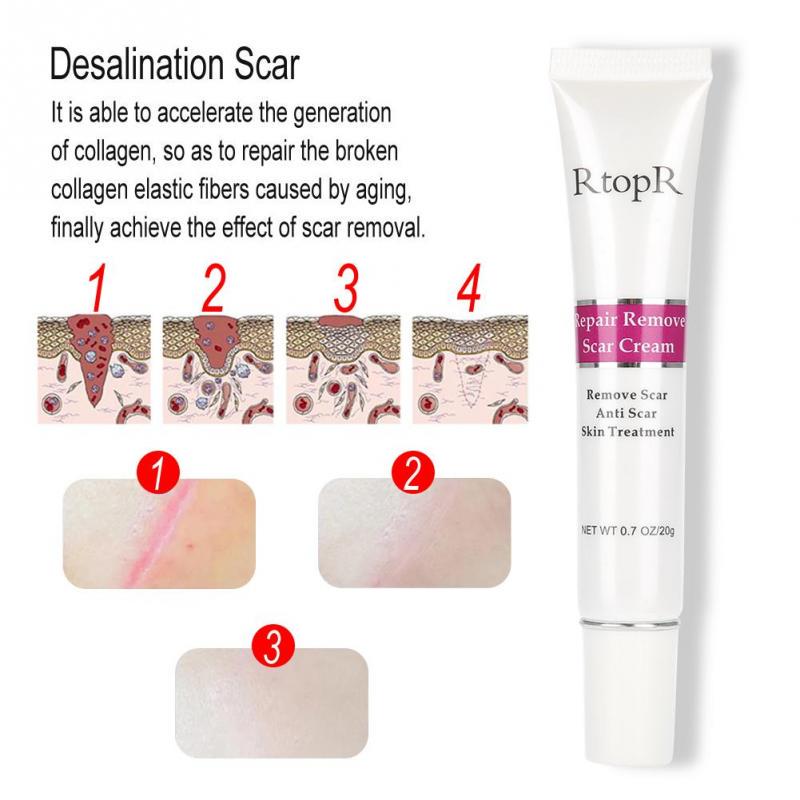 rtopr repair remove scar cream