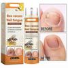 3X Bee Venom Nail Repair Serum, Nail Care Solution, Natural Bee Venom Nail Care Spray, Ingrown Toenail Care Spray