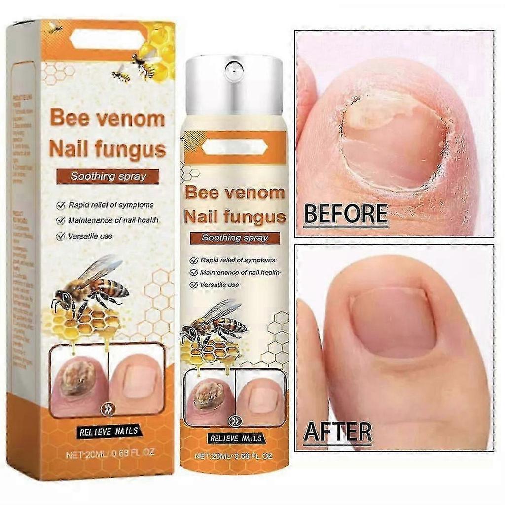3X Bee Venom Nail Repair Serum, Nail Care Solution, Natural Bee Venom Nail Care Spray, Ingrown Toenail Care Spray