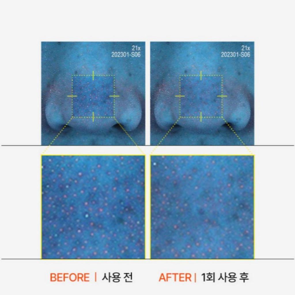 [P.CALM] Barrier Cycle Toner Pad 60pads (160ml)