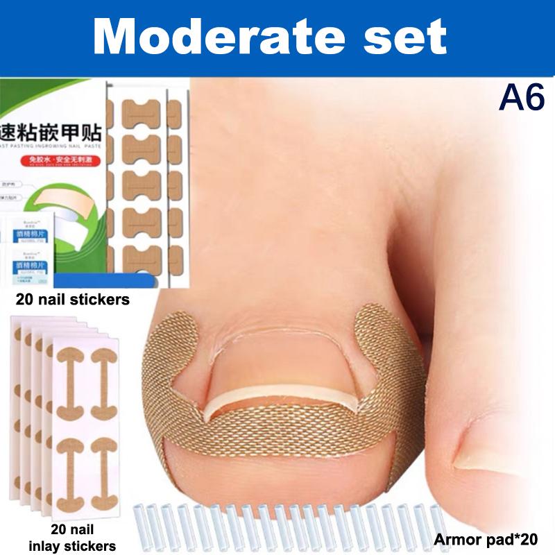 Ingrown Toenail Toe Correction Stickers Paronychia Treatment Recover Corrector Patches Feet Care Paronychia Treatment Recover