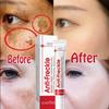 Neue leistungsstarke Fleckenentfernungs-Aufhellungscreme Hellt die Haut schnell auf Eliminiert Melanin-Pigmentierung Melasma Dunkle Flecken Koreanische Hautpflege