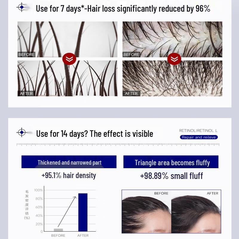 H18 Anti-Hair Loss & Hair Growth Series