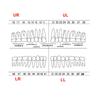 Fit Frasaco AG3 Typodont Dental Teeth Model Full teeth 32Pcs Screw-in Practice Filling Soft Gum Gingivae Teeth Training Teach