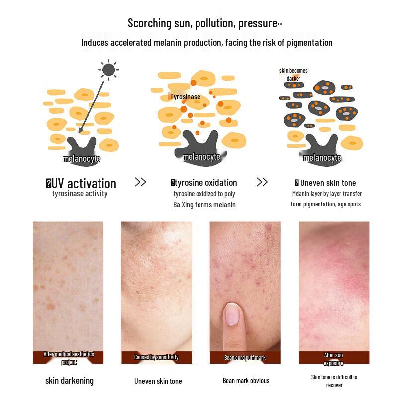 Tranexamsäure Aufhellungs- & Fleckenentfernungs-Essenz
