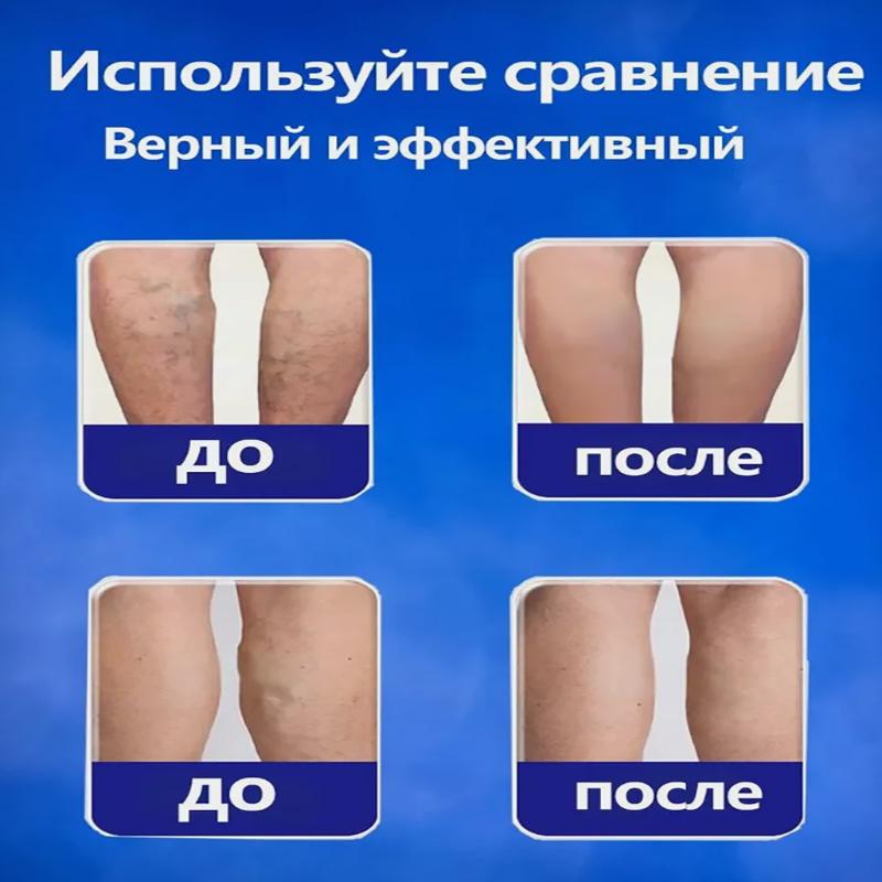 Vein Health Patch, Remove Leg Pain And Swelling Varicose Blood Vessels Earthworm Leg Vein Health Patch